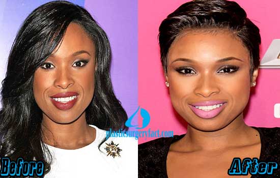 jennifer-hudson-plastic-surgery-before-and-after